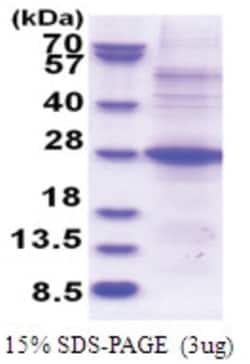 Novus Biologicals&trade;&nbsp;Recombinant Human POMZP3 His Protein