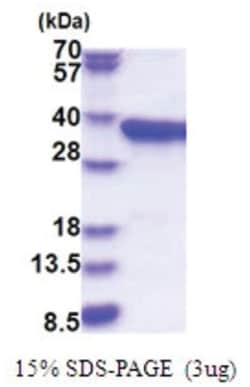 Novus Biologicals&trade;&nbsp;Recombinant Human PPA2 His Protein