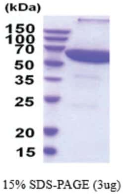 Novus Biologicals Recombinant Human PPP2R1A His Protein 0,1 mg | Buy Online | Novus Biologicals&trade; | Fisher Scientific