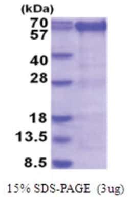 Novus Biologicals&trade;&nbsp;Recombinant Human PRMT3 His Protein