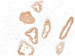Kallikrein 3/PSA Antibody (A67-B/E3), Novus Biologicals 0.2mg; Unlabeled:Antibodies,