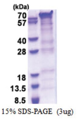 Novus Biologicals&trade;&nbsp;Recombinant Human PRRT2 His Protein