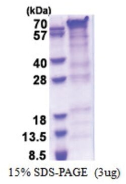 Novus Biologicals Recombinant Human PRRT2 His Protein 0.25 mg | Buy Online | Novus Biologicals&trade; | Fisher Scientific