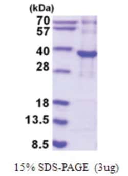 Novus Biologicals&trade;&nbsp;Recombinant Human PYCR2 His Protein