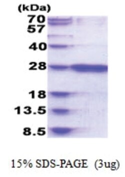 Novus Biologicals&trade;&nbsp;Recombinant Human RAB39B His Protein