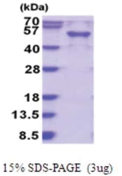 Novus Biologicals&trade;&nbsp;Recombinant Human RAB3IL1 His Protein