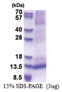Novus Biologicals&trade;&nbsp;Recombinant Human RAMP1 His Protein