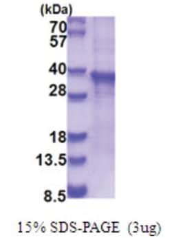 Novus Biologicals&trade;&nbsp;Recombinant Human RASL12 His Protein