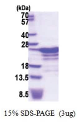 Novus Biologicals&trade;&nbsp;Recombinant Human RBM18 His Protein
