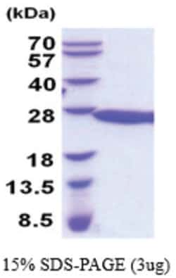 Novus Biologicals&trade;&nbsp;Recombinant Mouse RKIP/PBP His Protein