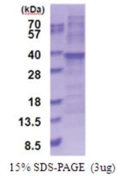 Novus Biologicals Recombinant Human RPL7A His Protein 0.25 mg | Buy Online | Novus Biologicals&trade; | Fisher Scientific