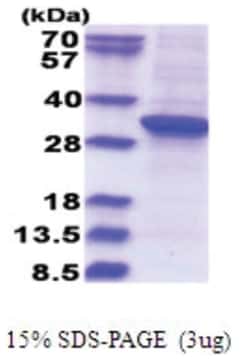 Novus Biologicals&trade;&nbsp;Recombinant Human RSU1 His Protein