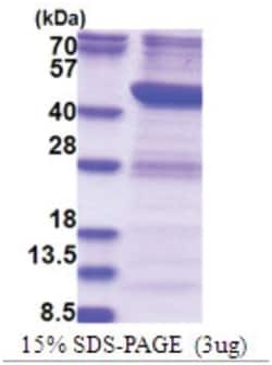 Novus Biologicals&trade;&nbsp;Recombinant Human RTCD1 His Protein