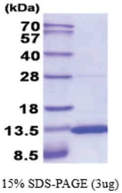 Novus Biologicals&trade;&nbsp;Recombinant Mouse S100A10 His Protein