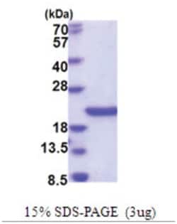 Novus Biologicals&trade;&nbsp;Recombinant Human SCO1 His Protein