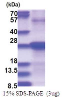 Novus Biologicals&trade;&nbsp;Recombinant Human SDF2 His Protein