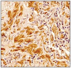 Senataxin Antibody (4G1) - BSA Free, Novus Biologicals 0.025mg; Unlabeled:Antibodies,