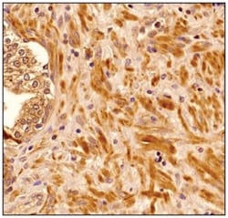 Senataxin Antibody (5D8) - BSA Free, Novus Biologicals 0.1mg; Unlabeled:Antibodies,