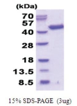 Novus Biologicals Recombinant Human Septin-3 His Protein 0,1 mg | Buy Online | Novus Biologicals&trade; | Fisher Scientific
