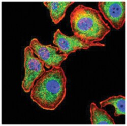 Serpin A1/alpha 1-Antitrypsin Antibody (5D1D2) - BSA Free, Novus Biologicals:Antibodies:Primary