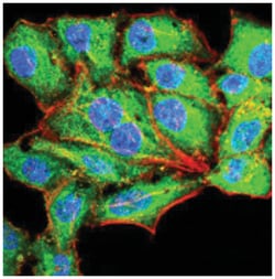 Serpin A1/alpha 1-Antitrypsin Antibody (5D1D2) - BSA Free, Novus Biologicals:Antibodies:Primary