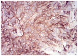 Serpin A1/alpha 1-Antitrypsin Antibody (5D1D2) - BSA Free, Novus Biologicals:Antibodies:Primary