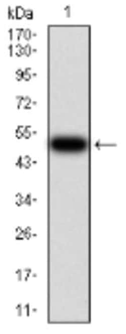 Serpin A1/alpha 1-Antitrypsin Antibody (5D1D2) - BSA Free, Novus Biologicals:Antibodies:Primary