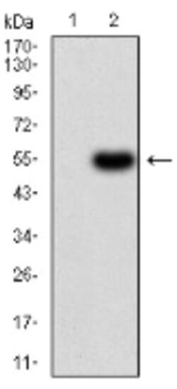Serpin A1/alpha 1-Antitrypsin Antibody (5D1D2) - BSA Free, Novus Biologicals:Antibodies:Primary