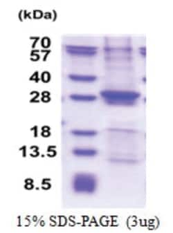 Novus Biologicals&trade;&nbsp;Recombinant Human SIKE1 His Protein