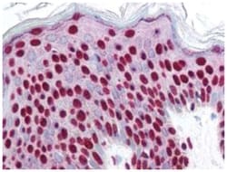Smad3, p Ser423, p Ser425 Antibody, Novus Biologicals™