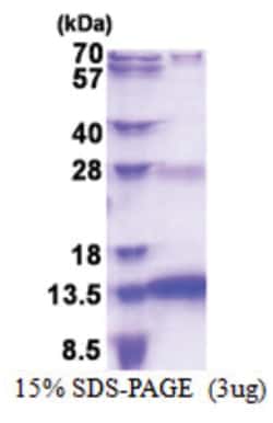 Novus Biologicals&trade;&nbsp;Recombinant Human SNURF His Protein
