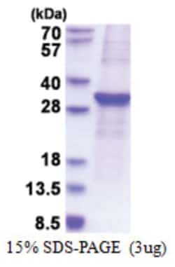 Novus Biologicals&trade;&nbsp;Recombinant Human SOCS-3 His Protein