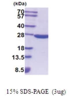Novus Biologicals&trade;&nbsp;Recombinant Mouse SOD2/Mn-SOD His Protein