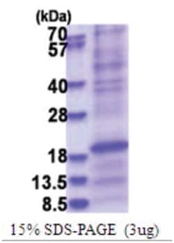 Novus Biologicals&trade;&nbsp;Recombinant Human SP-D His Protein