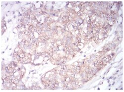 Sphingosine Kinase 2/SPHK2 Antibody (9C5E1) - BSA Free, Novus Biologicals