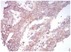 Sphingosine Kinase 2/SPHK2 Antibody (9C5E1) - BSA Free, Novus Biologicals