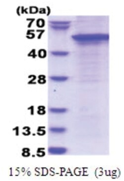 Novus Biologicals&trade;&nbsp;Recombinant Human STAC His Protein