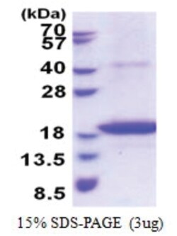 Novus Biologicals Recombinant Human STAMP2/STEAP4 His Protein 0.1 mg | Buy Online | Novus Biologicals&trade; | Fisher Scientific