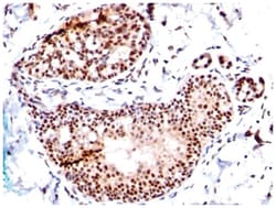 SUMO1 Mouse, Clone: SM1/495, Novus Biologicals 0.1mg; Unlabeled:Antibodies,