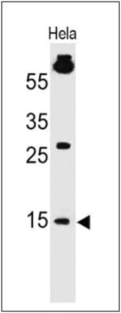 SUMO1 Antibody (SPM571), Novus Biologicals:Antibodies:Primary Antibodies
