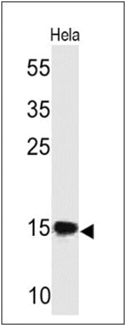 SUMO2/3 Antibody (SM23/496), Novus Biologicals 0.02mg; Unlabeled:Antibodies,
