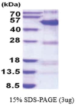 Novus Biologicals&trade;&nbsp;Recombinant Human SYT11 His Protein