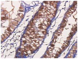 TAG-72 Antibody (B72.3 (Satumomab)) - Chimeric - Azide and BSA Free, Novus