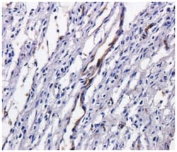 TAG-72 Antibody (B72.3 (Satumomab)) - Chimeric - Azide and BSA Free, Novus
