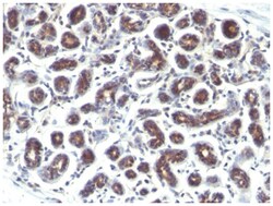 TFF1/pS2 Mouse, Clone: GE2 (same as R47/94), Novus Biologicals 0.1mg; Unlabeled:Antibodies,