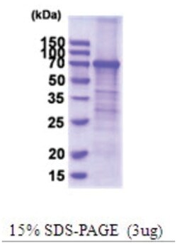 Novus Biologicals Recombinant Human TfR (Transferrin R) His Protein 0.5 mg | Buy Online | Novus Biologicals&trade; | Fisher Scientific
