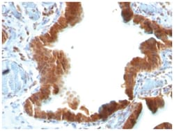 TGF-alpha Mouse, Clone: P/T1, Novus Biologicals 0.02mg; Unlabeled:Antibodies,