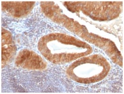 TGF-alpha Mouse, Clone: P/T1, Novus Biologicals 0.02mg; Unlabeled:Antibodies,