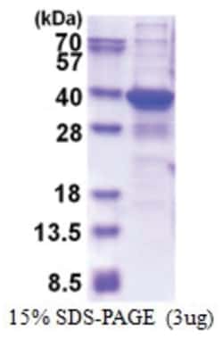 Novus Biologicals Recombinant Human TGIF2LX His Protein 0.5 mg | Buy Online | Novus Biologicals&trade; | Fisher Scientific