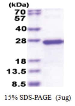 Novus Biologicals Recombinant Human TGIF2LY His Protein 0.5 mg | Buy Online | Novus Biologicals&trade; | Fisher Scientific